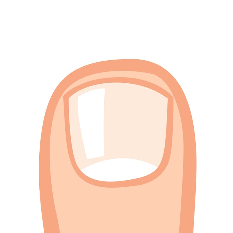 toenail